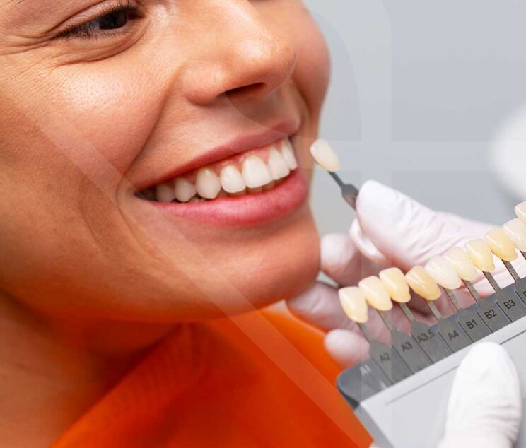 Zirconium Crown