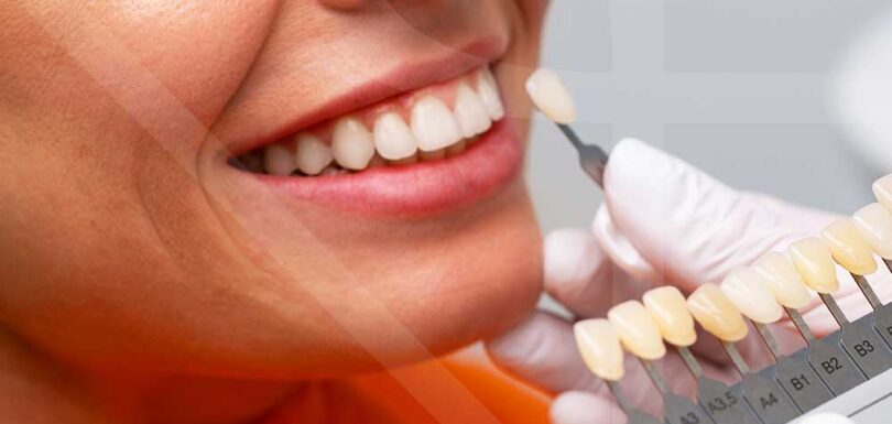Zirconium Crown