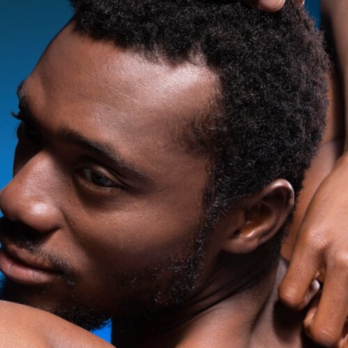Afro Hair Transplant