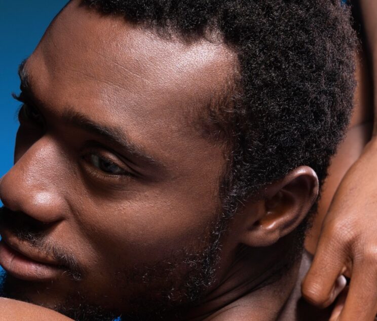 Afro Hair Transplant