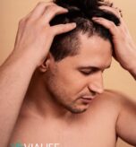How-DHI-Hair-Transplant-Works-Advanced-Hair-Restoration