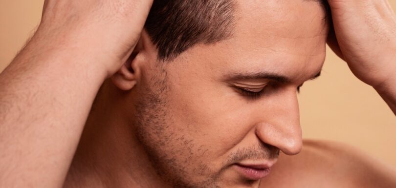 How-DHI-Hair-Transplant-Works-Advanced-Hair-Restoration